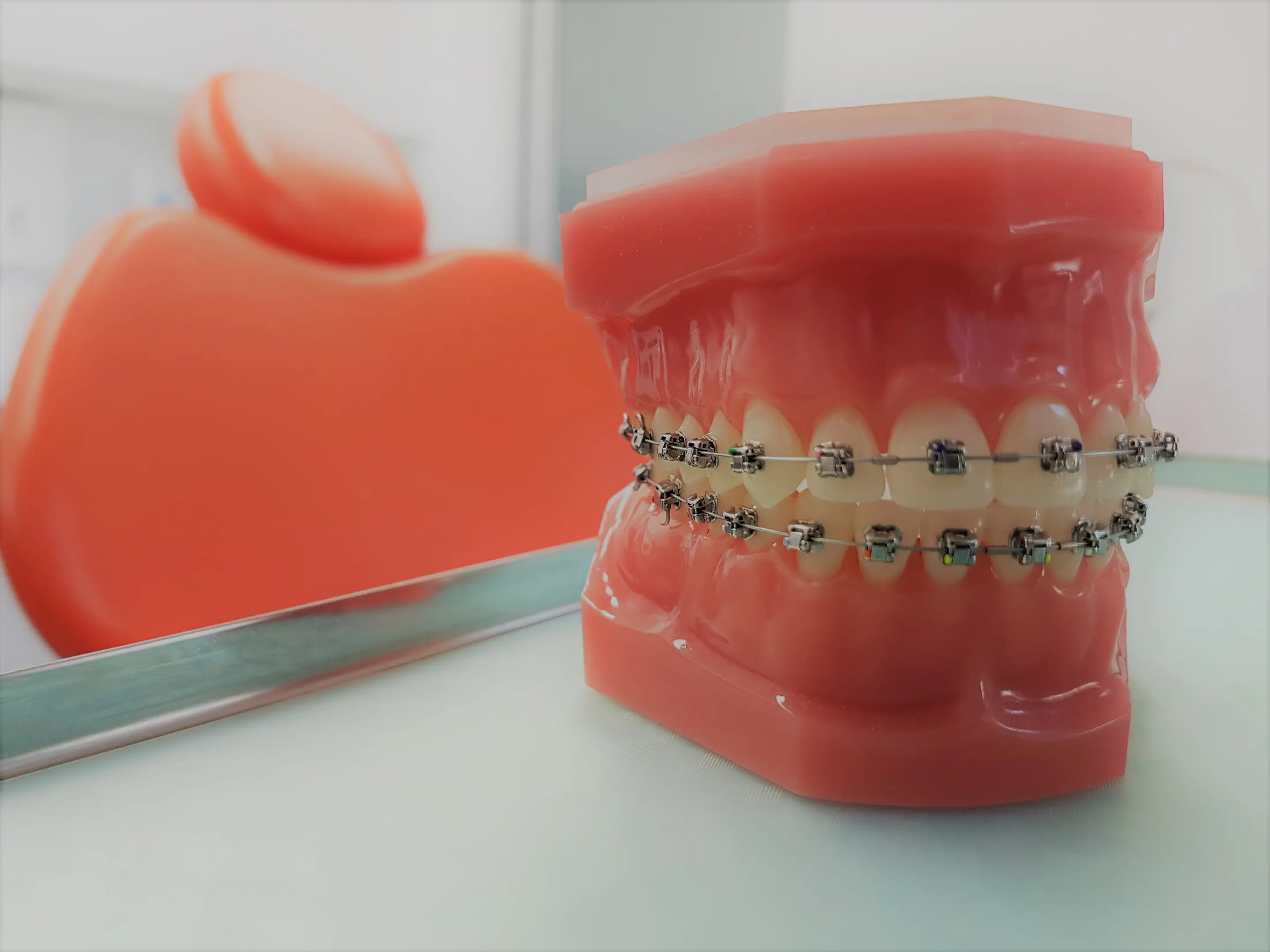Braces Model