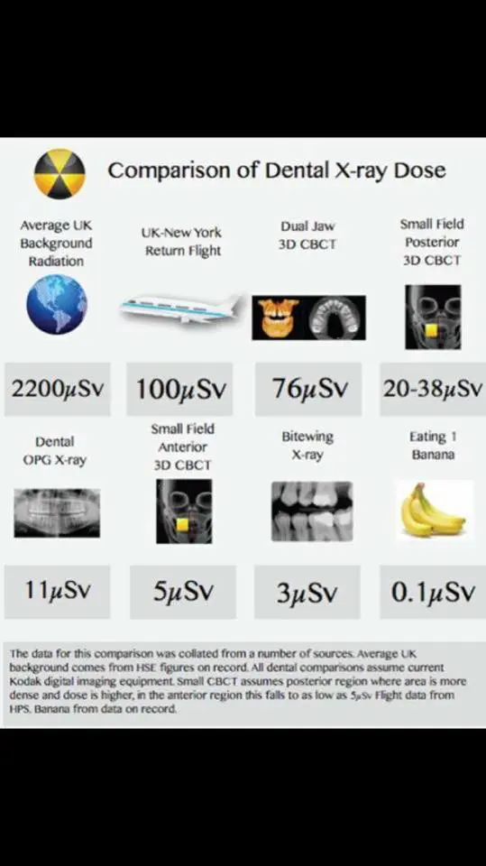 Radiation Dose Chart