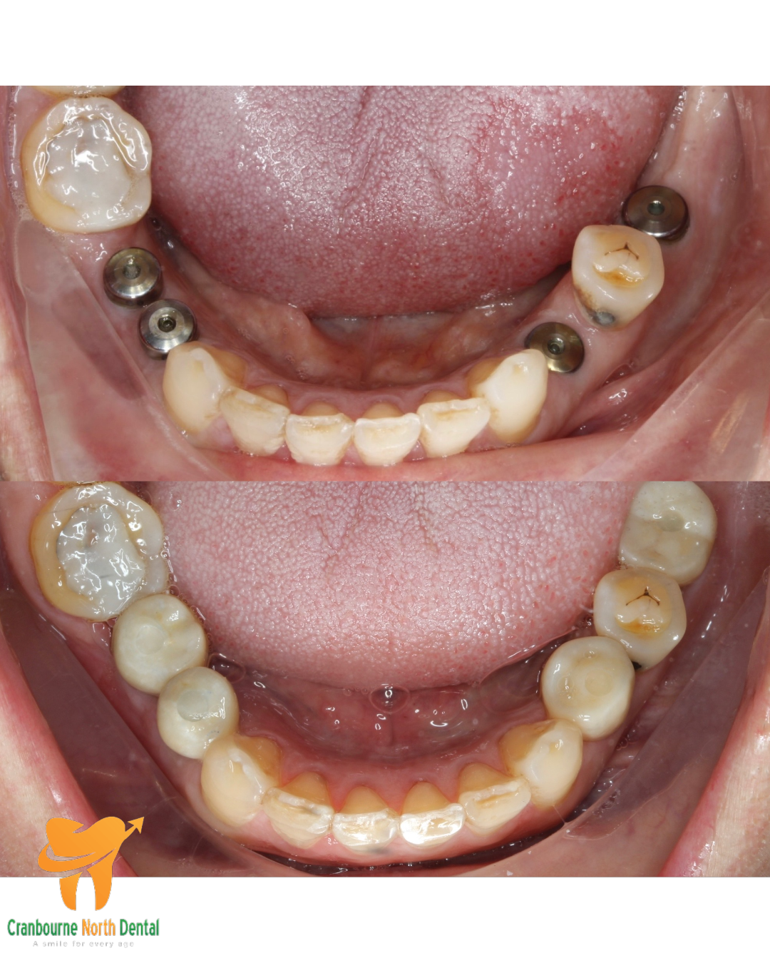 Image2