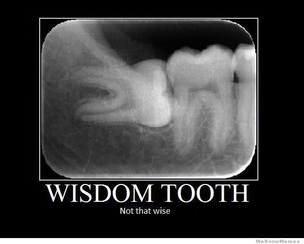 Wisdom Tooth Not That Wise Funny Teeth Meme Picture
