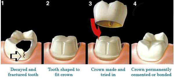 Crown process diagram