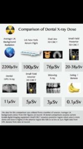 radiation dose chart