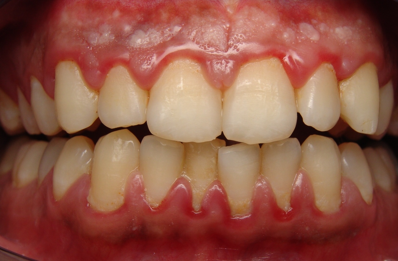 gum disease tell dental cranbourne north author
