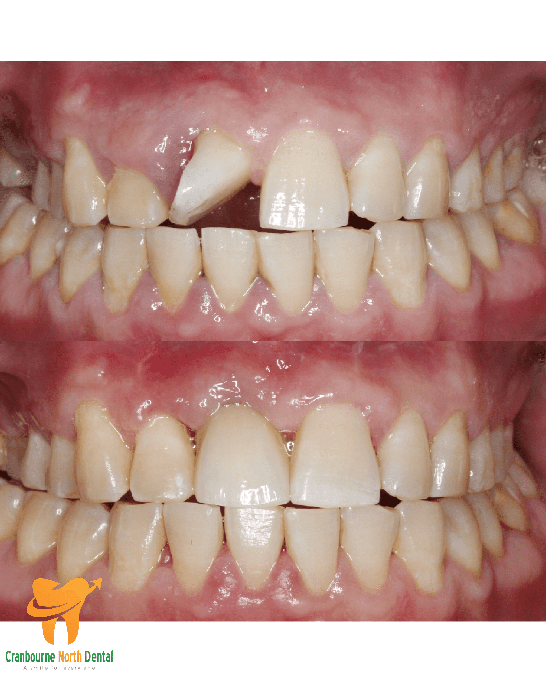 welcome-karen-cranbourne-north-dental