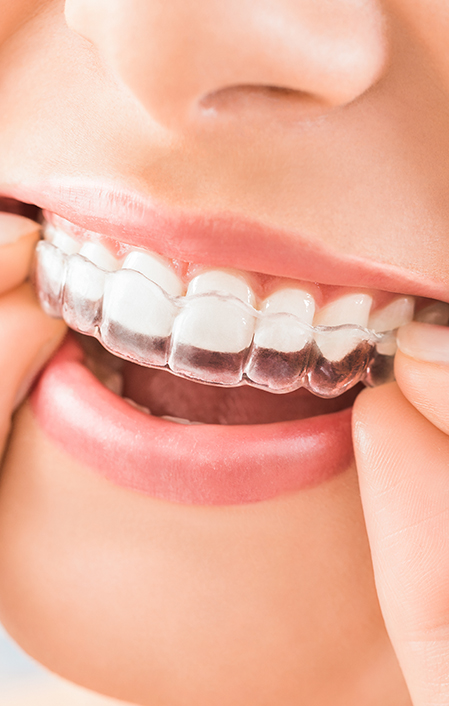 Beautiful Smile And White Teeth Of A Young Woman. 853577296 6720x4112