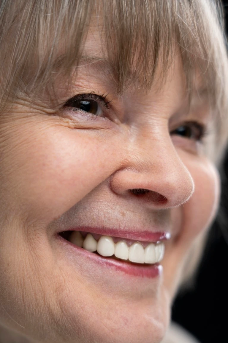 Close Up Old Person Portrait With Full Mouth Dental Implants